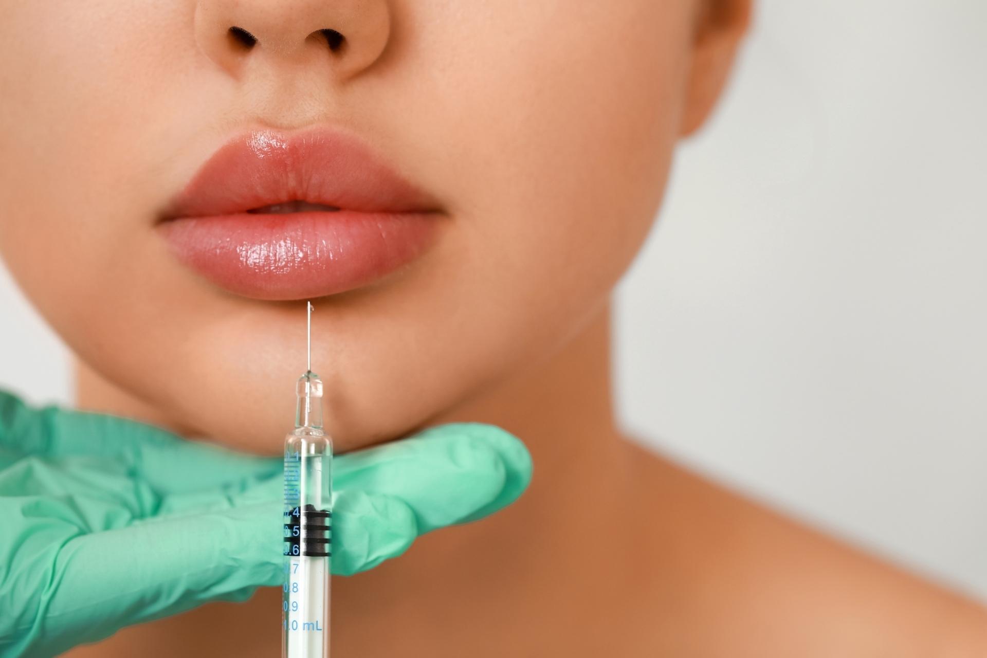 Russian Lips : comprendre cette technique d'injection pour des lèvres naturellement pulpeuses
